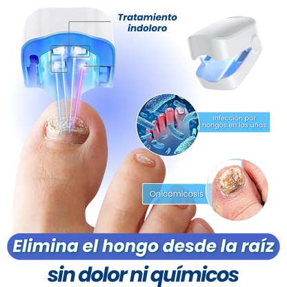 Quita Hongos LED Pro Max - Ataca el hongo profundo sin dolor (7 minutos al día)